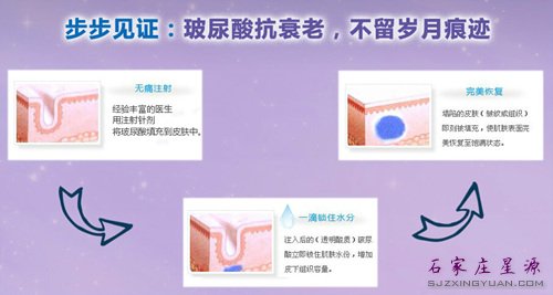 注射玻尿酸